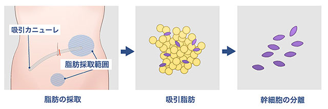 慢性疼痛緩和1