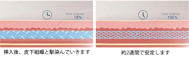 テスリフト_02